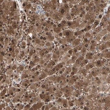 Anti-EVC antibody produced in rabbit Ab1, Prestige Antibodies&#174; Powered by Atlas Antibodies, affinity isolated antibody, buffered aqueous glycerol solution