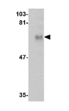 Anti-CPEB1 Antibody from rabbit, purified by affinity chromatography