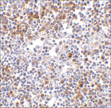 Anti-MDA5 antibody produced in rabbit affinity isolated antibody, buffered aqueous solution