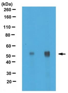 Anti-alpha Tubulin Antibody, nontyrosinated serum, from rabbit