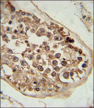 ANTI-DEPDC1 (N-TERM) antibody produced in rabbit IgG fraction of antiserum, buffered aqueous solution