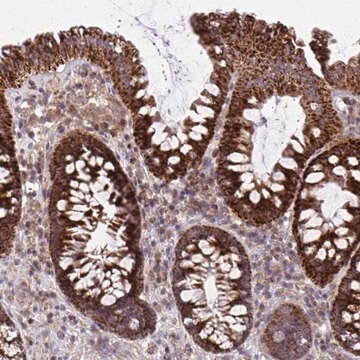 Anti-C16orf54 antibody produced in rabbit Prestige Antibodies&#174; Powered by Atlas Antibodies, affinity isolated antibody, buffered aqueous glycerol solution