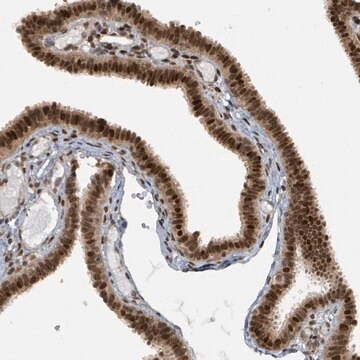 Anti-PHIP antibody produced in rabbit Prestige Antibodies&#174; Powered by Atlas Antibodies, affinity isolated antibody, buffered aqueous glycerol solution