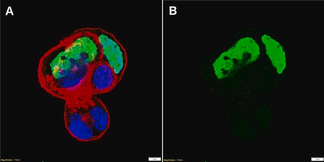 Anti-SALL4 Antibody, clone 1H18 ZooMAb&#174; Rabbit Monoclonal recombinant, expressed in HEK 293 cells