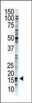 Anti-USP29 (N-term) antibody produced in rabbit IgG fraction of antiserum, buffered aqueous solution