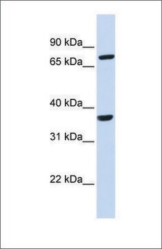 Anti-CCRL2 antibody produced in rabbit affinity isolated antibody