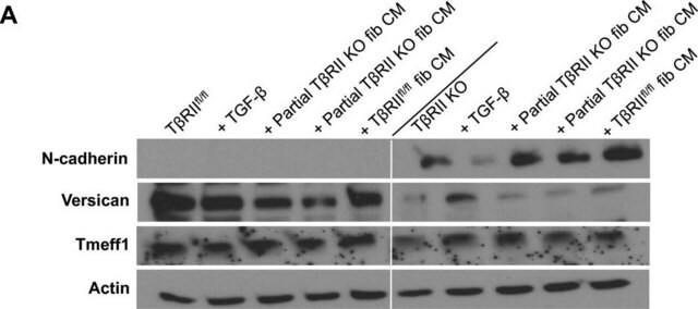 Anticuerpo anti-versicano, a.a. 1360-1439 de versicano murino Chemicon&#174;, from rabbit