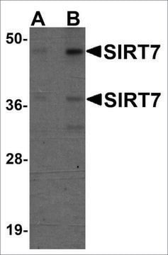 Anti-SIRT7 antibody produced in chicken affinity isolated antibody, buffered aqueous solution