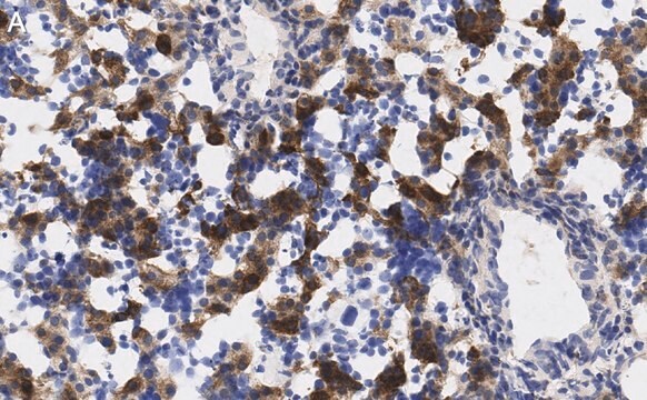 Anti-AFP Antibody, clone 3B7 ZooMAb&#174; Rabbit Monoclonal recombinant, expressed in HEK 293 cells