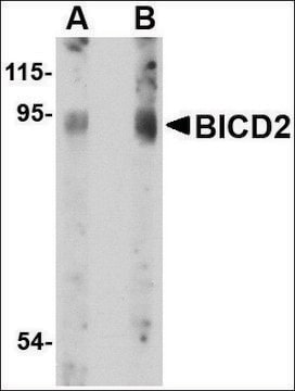 Anti-BICD2 antibody produced in rabbit affinity isolated antibody, buffered aqueous solution