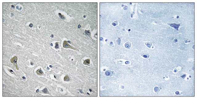 Anti-MYLIP antibody produced in rabbit affinity isolated antibody