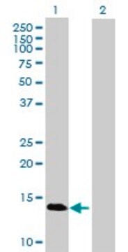 Anti-GBA3 antibody produced in mouse purified immunoglobulin, buffered aqueous solution