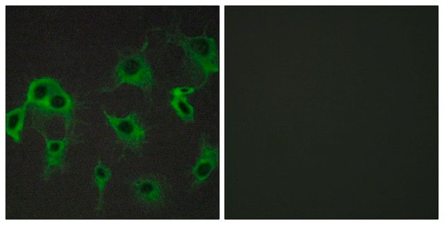 Anti-ADRB2 antibody produced in rabbit affinity isolated antibody