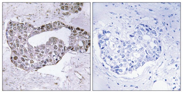 Anti-GATA1 antibody produced in rabbit affinity isolated antibody