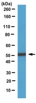 Anti-RhoGAP1 Antibody from rabbit, purified by affinity chromatography