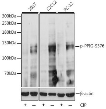 Anti-Phospho-PPIG-S376 antibody produced in rabbit