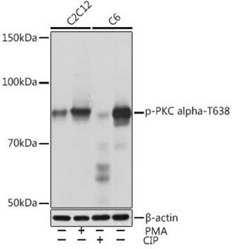 Anti-Phospho-PKC alpha-T638 antibody produced in rabbit