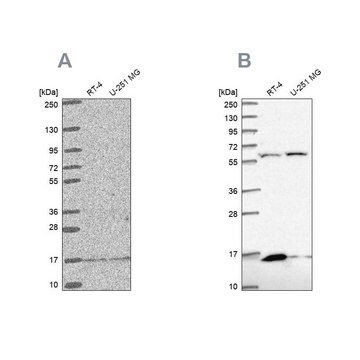 Anti-MRPS16 antibody produced in rabbit Prestige Antibodies&#174; Powered by Atlas Antibodies, affinity isolated antibody, buffered aqueous glycerol solution