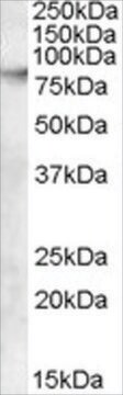 Anti-ABCB5 antibody produced in goat affinity isolated antibody, buffered aqueous solution