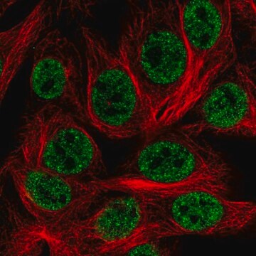 Anti-HOXD1 antibody produced in rabbit Prestige Antibodies&#174; Powered by Atlas Antibodies, affinity isolated antibody