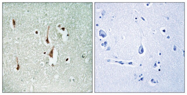 Anti-CYCLIN D1, C-Terminal antibody produced in rabbit affinity isolated antibody