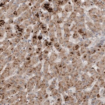 Anti-SCP2 antibody produced in rabbit Prestige Antibodies&#174; Powered by Atlas Antibodies, affinity isolated antibody, buffered aqueous glycerol solution, Ab1