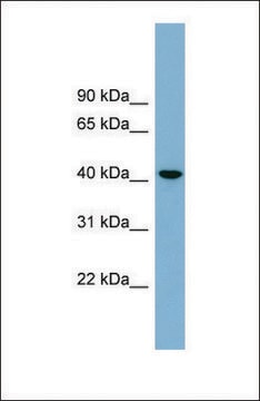 Anti-B4GALT2 antibody produced in rabbit affinity isolated antibody