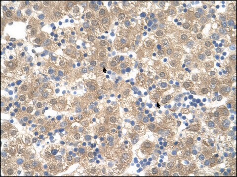 Anti-PPIB (AB2) antibody produced in rabbit IgG fraction of antiserum