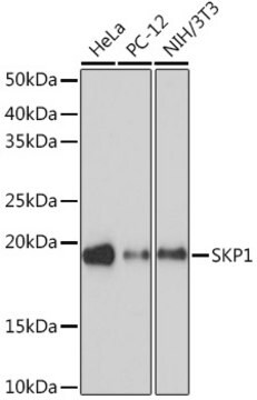 Anti-SKP1 Antibody, clone 10G5X5, Rabbit Monoclonal