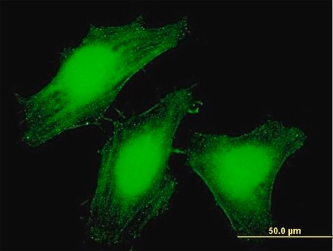 Anti-LARP6 antibody produced in mouse purified immunoglobulin, buffered aqueous solution