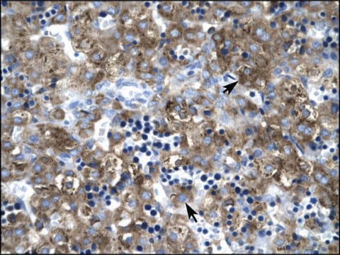 Anti-CLDN1 antibody produced in rabbit affinity isolated antibody