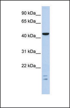 Anti-BTBD6 antibody produced in rabbit affinity isolated antibody