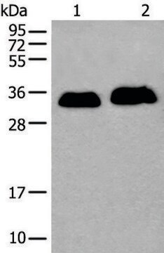 Anti-ATP1B2 affinity isolated antibody