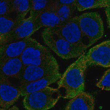 Anti-Cfl1 Antibody Produced In Rabbit Prestige Antibodies&#174; Powered by Atlas Antibodies, affinity isolated antibody, buffered aqueous glycerol solution