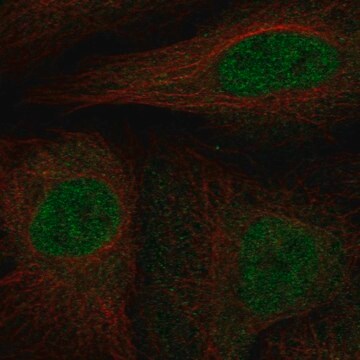 Anti-Cdkn2B Antibody Produced In Rabbit Prestige Antibodies&#174; Powered by Atlas Antibodies, affinity isolated antibody, buffered aqueous glycerol solution