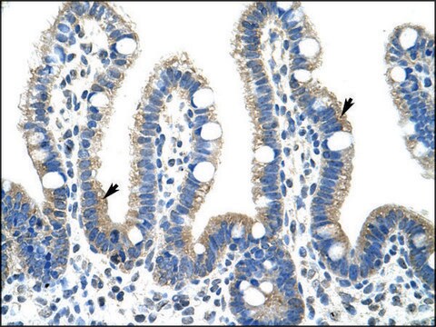 Anti-FBL antibody produced in rabbit IgG fraction of antiserum