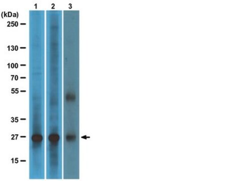 Anti-RalB Antibody, clone 25 clone 25, Upstate&#174;, from mouse