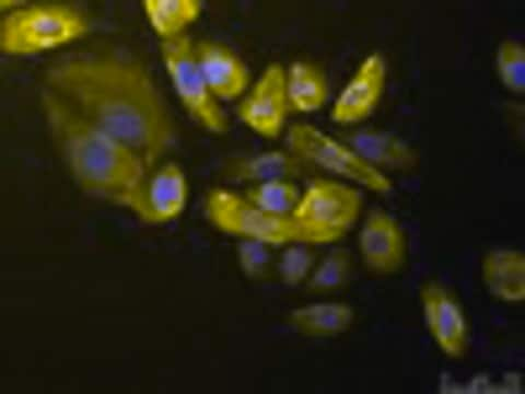 NP69 Human Nasopharyngeal Epithelial Cell Line The NP69 cell line is useful for studies of the mechanisms of viral-associated tumorigenesis