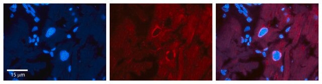 Anti-SF1 antibody produced in rabbit affinity isolated antibody