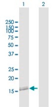 Anti-NANOS2 antibody produced in mouse purified immunoglobulin, buffered aqueous solution