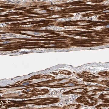 Anti-OSBPL9 antibody produced in rabbit affinity isolated antibody, buffered aqueous glycerol solution