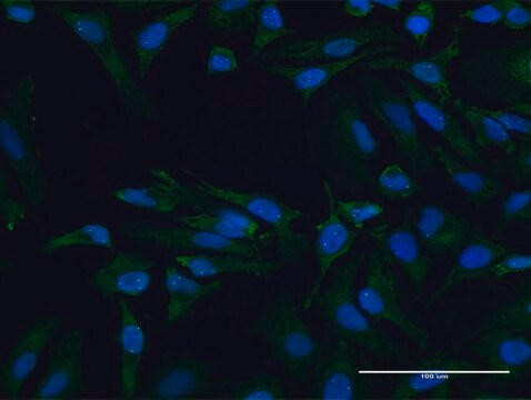 Anti-SMN2 antibody produced in mouse purified immunoglobulin, buffered aqueous solution