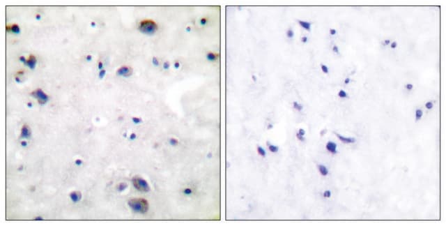 Anti-Opioid Receptor antibody produced in rabbit affinity isolated antibody