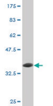 Monoclonal Anti-UBE3A antibody produced in mouse clone 3E5, purified immunoglobulin, buffered aqueous solution