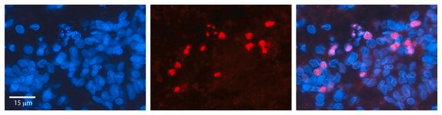 Anti-RORA antibody produced in rabbit affinity isolated antibody