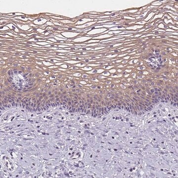 Anti-GSDMC antibody produced in rabbit Prestige Antibodies&#174; Powered by Atlas Antibodies, affinity isolated antibody, buffered aqueous glycerol solution, Ab3