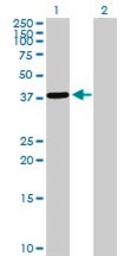 Anti-EPM2A antibody produced in rabbit purified immunoglobulin, buffered aqueous solution