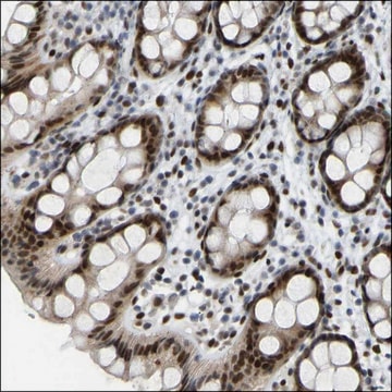 Anti-CD99L2 antibody produced in rabbit Prestige Antibodies&#174; Powered by Atlas Antibodies, affinity isolated antibody, buffered aqueous glycerol solution