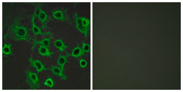 Anti-CCRL2 antibody produced in rabbit affinity isolated antibody