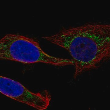 Anti-Mccc1 Antibody Produced In Rabbit Prestige Antibodies&#174; Powered by Atlas Antibodies, affinity isolated antibody, buffered aqueous glycerol solution